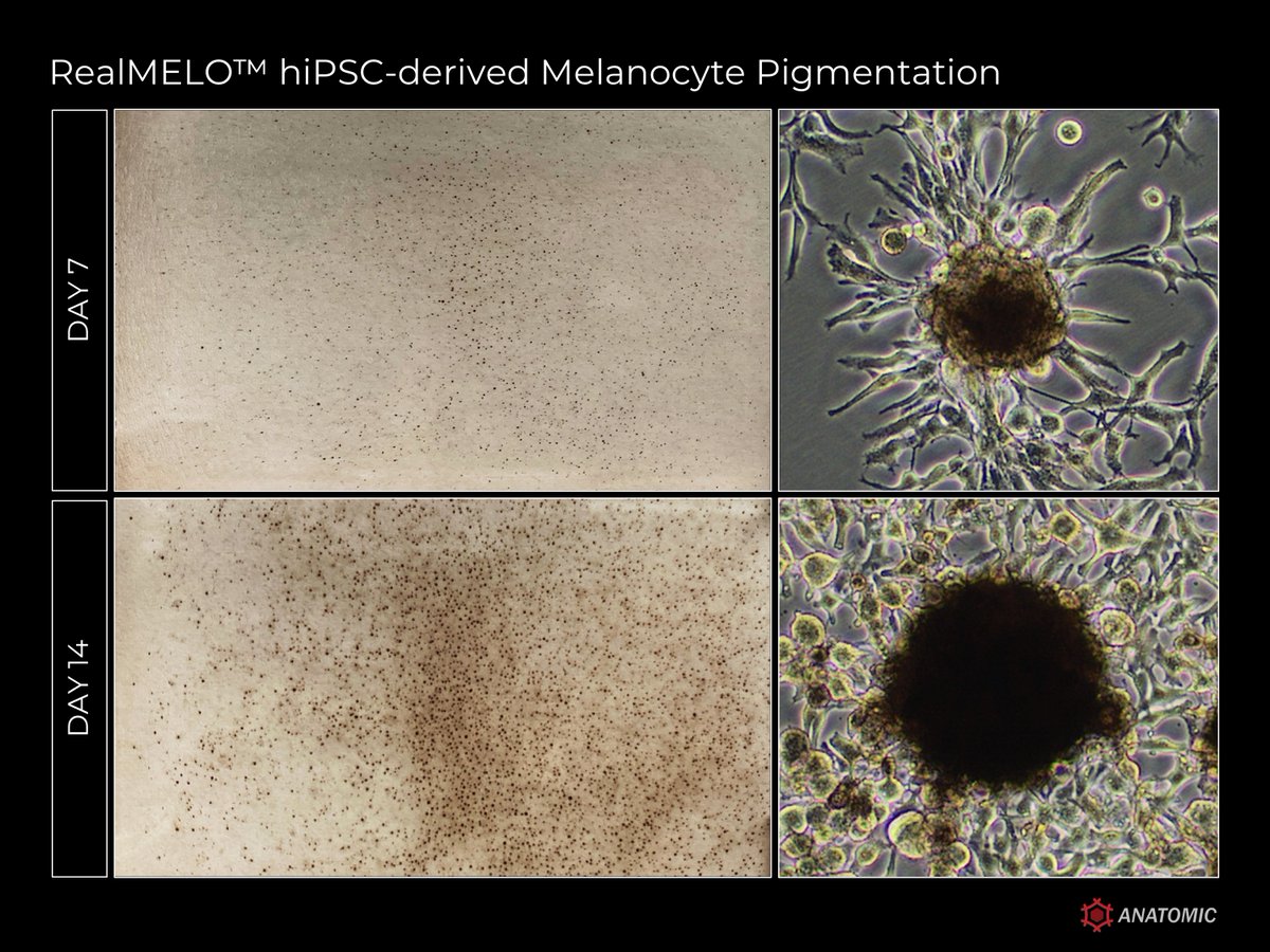 AnatomicTech's tweet image. 🔎How do you “spot” a melanocyte? You look with your naked eye! 

With RealMELO, Anatomic is going MACROSCOPIC! If your drug screen readout is pigmentation, the effects will be obvious in as little as 7 days post-thaw!

#CompleteTheCircuit #Vitiligo #Melanoma #Cosmetics