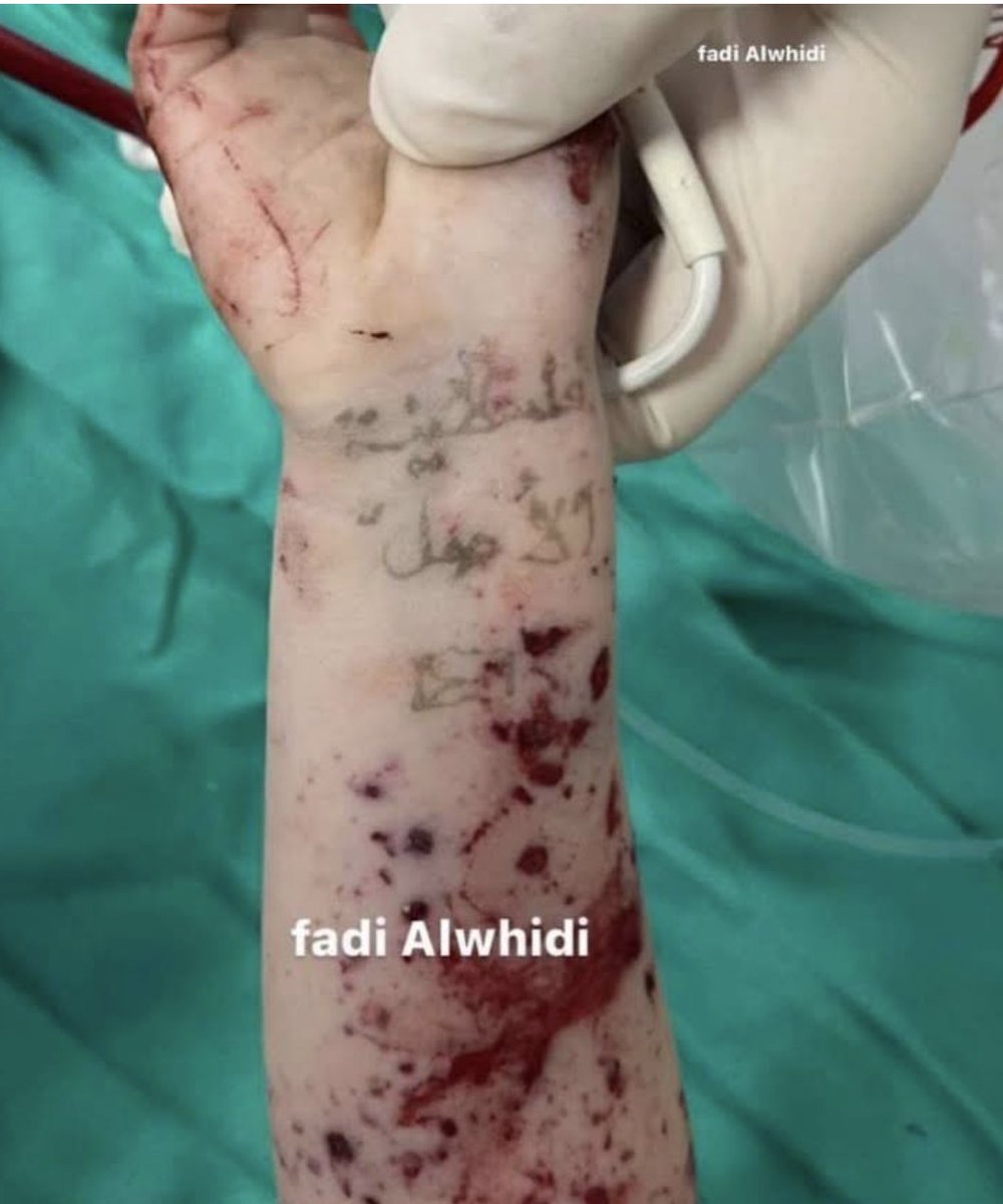 Auschwitz 1944 >>>       Gaza 2024