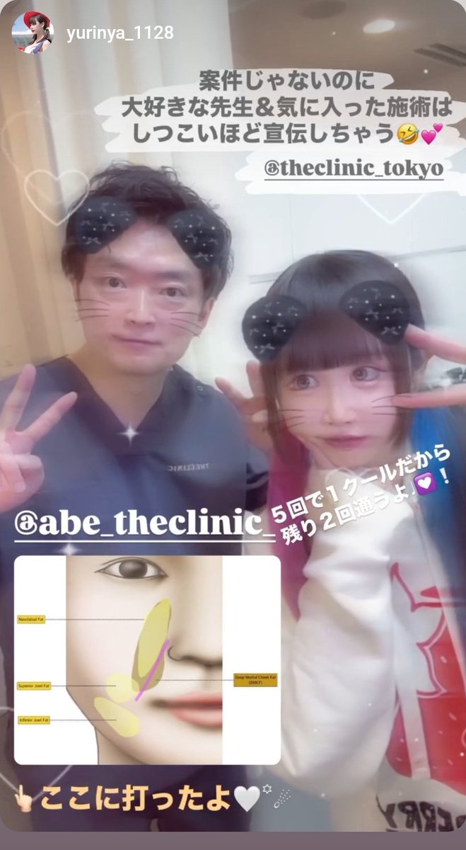 theclinic_abe's tweet photo. 第10回モフィウスプレゼント✨🎁✨
今回は記念回、なんと「ほうれい線」「口横のポニョ」をダブルで1名様に無料プレゼント🙆
先日もゆりにゃさんに全顔していただきました。
効果すごいそうです。
応募はアカウントフォローしてから、リポスト、いいねお願いします✨️
当選発表は18日正午です😎 https://t.co/3a7Xl9psfX