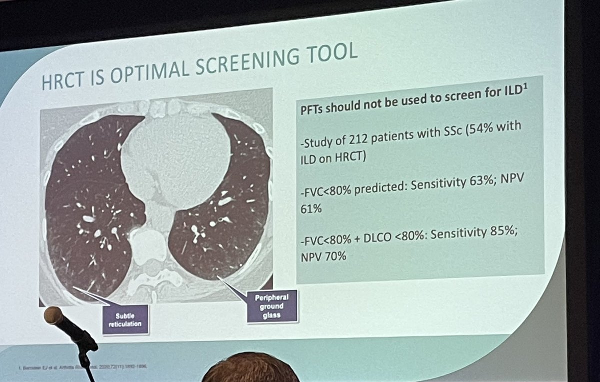 How do you screen your SSc patients for ILD? HRCT is the optimal screening tool over PFTs and XR. Dr. Elizabeth Volkmann <a href="/RheumNow/">Dr. John Cush</a> <a href="/RWCSmtg/">RWCS</a> #rwcs2025