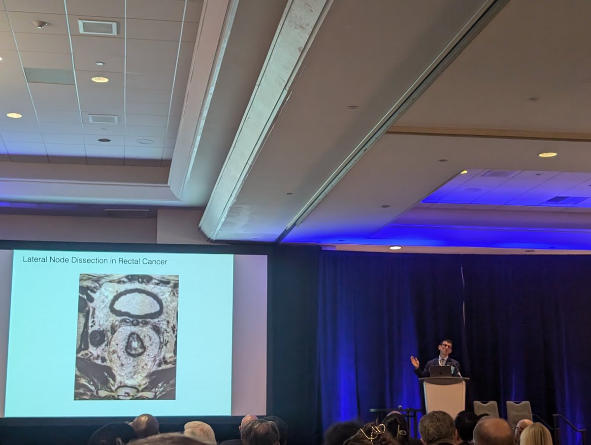 ZGaroufalia's tweet image. The absolutely amazing @R_Perez_MD giving a state of the art talk on #LLND @ #ICDS2025 @CleveClinicFL 

@SWexner @BoutrosMarylise