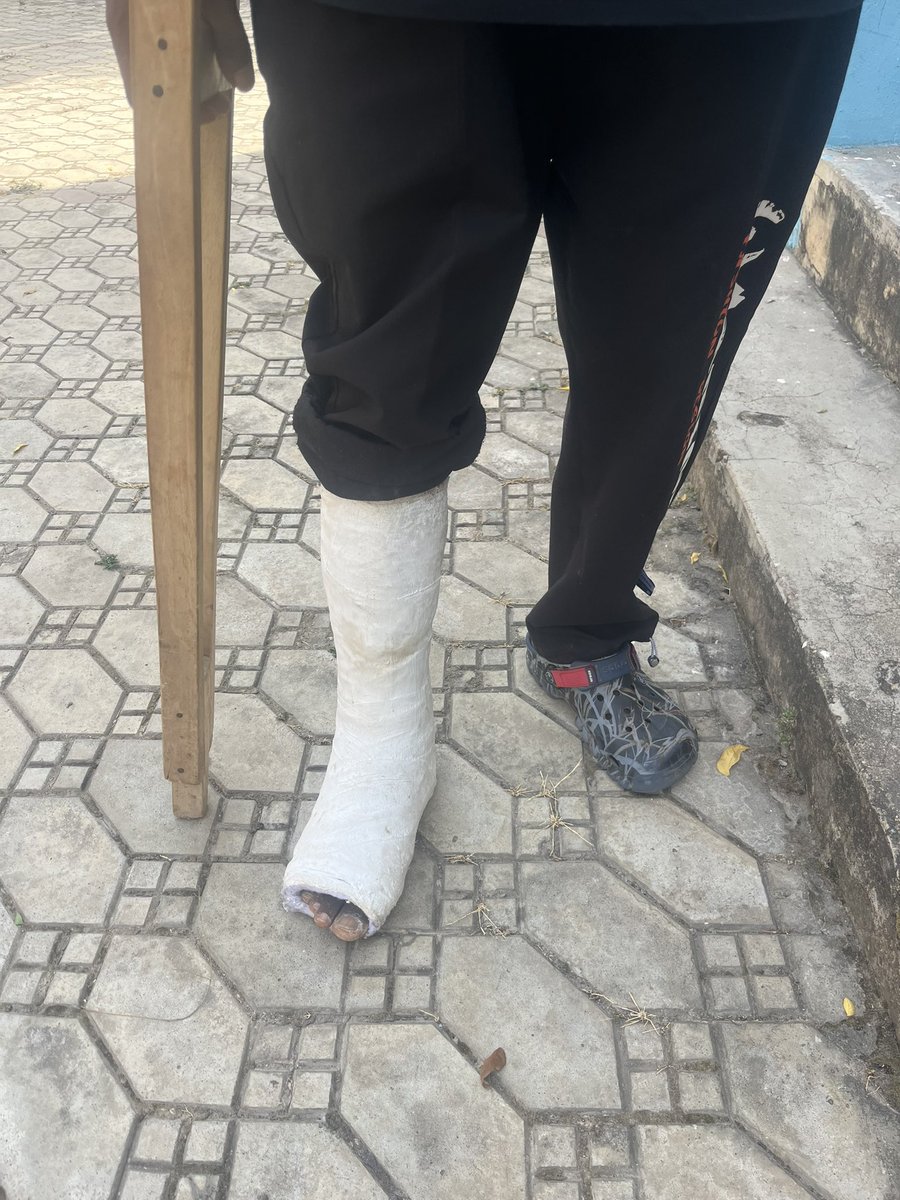 onlyoneTYNIE's tweet photo. @S27community continues to touch lives.
This person is suffering a fractured born on his right foot and have had cast on his leg about a month, making him unable to work. Had to make him feel the coming of 27SANTA🎅 sent him 10k to support his medication.
#27community #27santa https://t.co/Ve17ZhBLrA