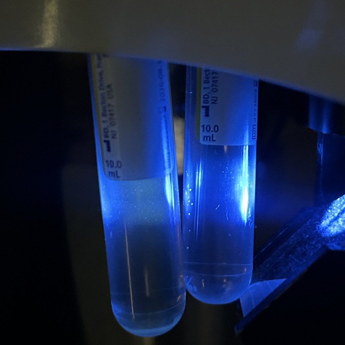 Trisha Laxamana MD π½π΅π (@nephrolotrish) on Twitter photo AKI, high anion gap & osmolal gap, bluish fluorescence under Woodβs lamp, & these crystals I proudly took photos of under the microscope (lol) β interesting day <a href="/NYUnephro/">NYU Nephrology</a> ! π
#urinemicroscopy #toxicology #nephrology AKI, high anion gap & osmolal gap, bluish fluorescence under Woodβs lamp, & these crystals I proudly took photos of under the microscope (lol) β interesting day <a href="/NYUnephro/">NYU Nephrology</a> ! π
#urinemicroscopy #toxicology #nephrology
