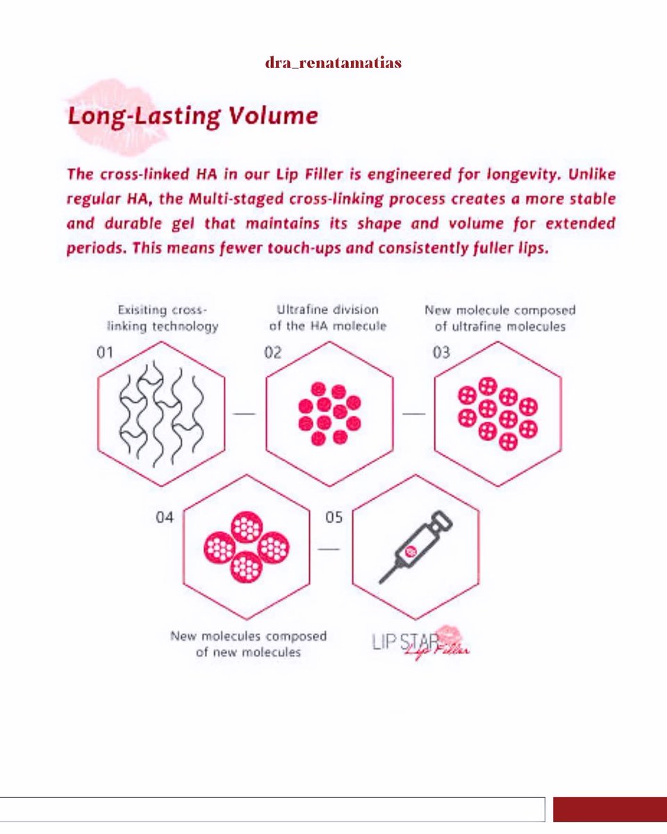 DraRenatamatias's tweet image. Lançado no IMCAS 2025 mais essa tecnologia avançada em ácido hialurônico, trazendo um agregado que é a cor que ilumina seus lábios em tom  avermelhado com um perfeito toque no preenchimento LABIAL.
👄 
#IMCAS2125 #preenchimentolabial #labios #labiosperfeitos