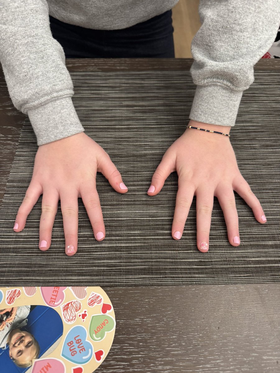 Getting into the Valentine’s Day spirit post-flu!

Facial swelling is almost all gone! 👏🏻
Girls nails are done! 💕
Hubs surprised me with flowers! 💐 

Normally not a flower person, but once in a blue 🌙 they are a treat! ♥️@DaveInTheHSV