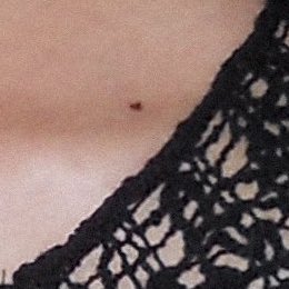 his heart shaped mole making an appearance on valentines day 🥹