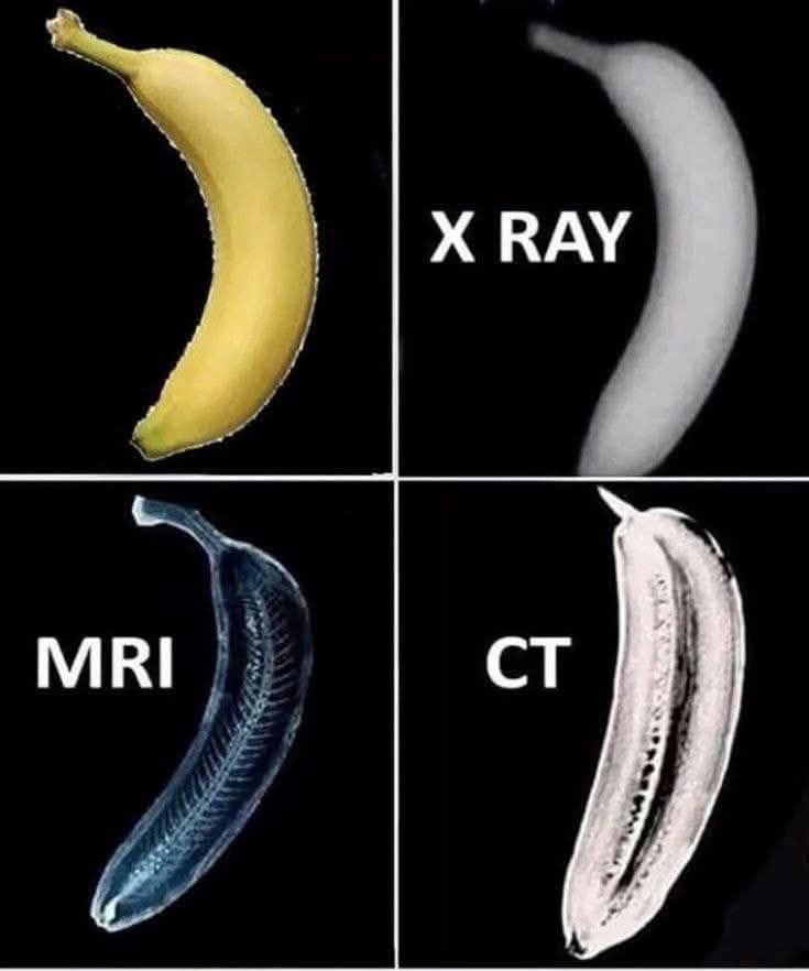 Informative Example for X-ray, MRI, and CT Scans