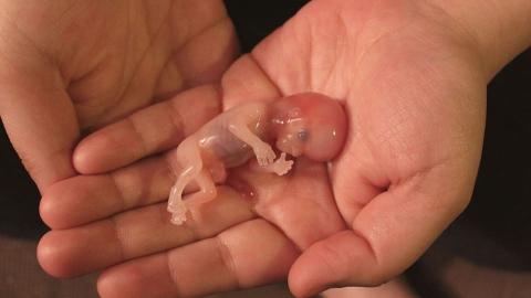 viajerospanish's tweet photo. @cordopolis_es Para aquellos que defienden el aborto y no lo califican de asesinato. A modo ilustrativo, bebé de 12 semanas: https://t.co/LXqPSjS7u2