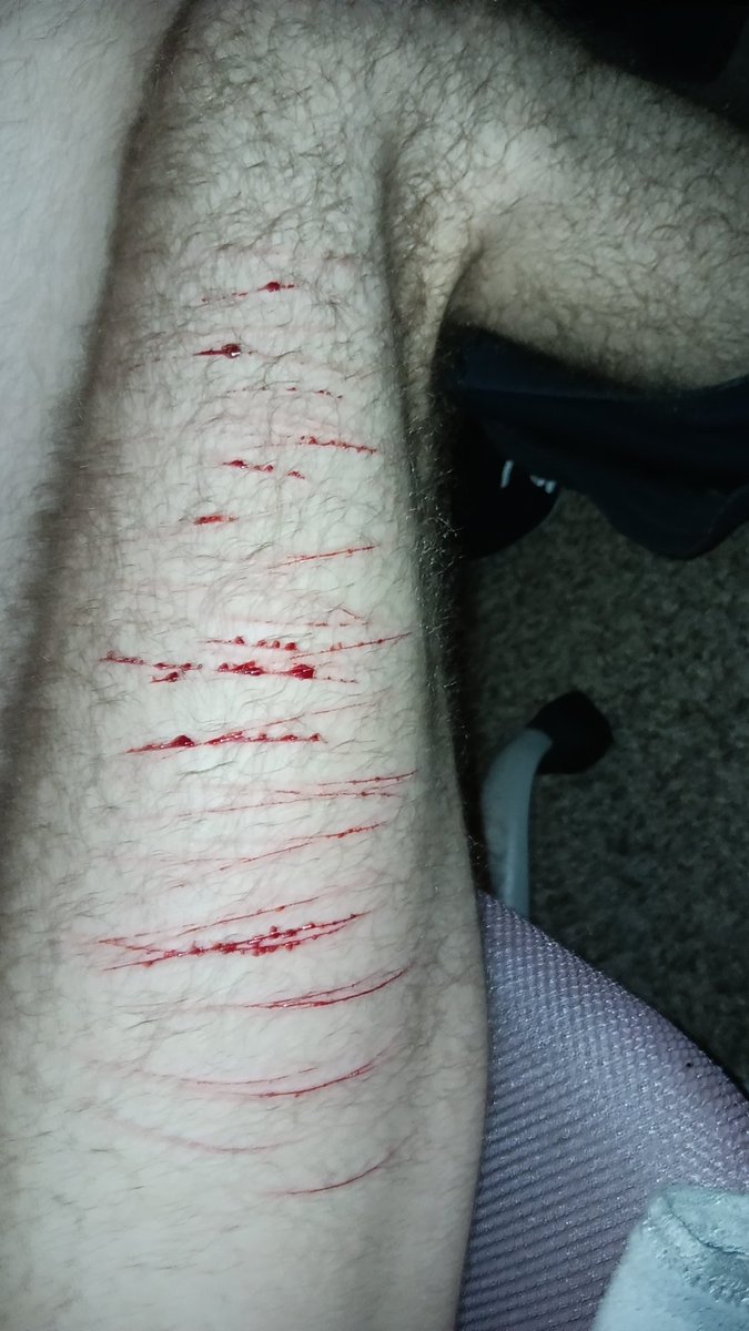 findingarden's tweet photo. Bf loved looking at this stuff, they left me last weekend.
#selfharm https://t.co/DZR814OOym