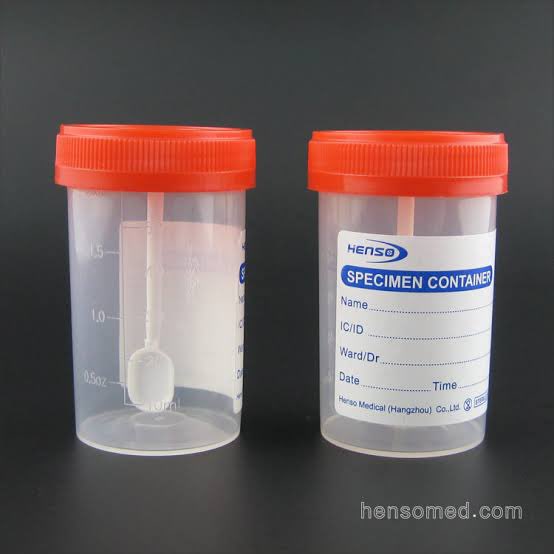 This is a stool sample collector. Please scoop with the little spoon. Usijaze yote.

The lab guys wanakasirika sana.