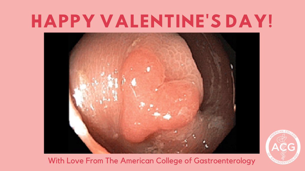 ❤️A heart-shaped polyp is the best way to wish HAPPY VALENTINE'S DAY to the #ACGfamily!❤️

With love &amp; deep respect for all the #PolypSlayers

Quality #Colonoscopy detects precancerous polyps and can prevent #ColorectalCancer

#GItwitter #Gastroenterology