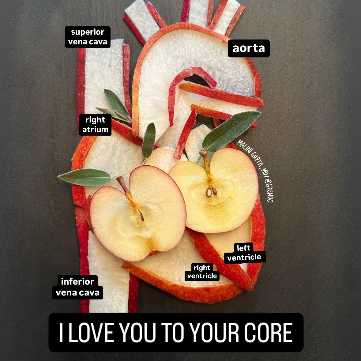 Malini Gupta, MD, FACE, ECNU (@maliniguptamd) on Twitter photo Happy #Valentinesday2025  Apples contain fiber and polyphenols, which have been found to be very powerful in heart health. #foodart #HeartHealth #MedEd Happy #Valentinesday2025  Apples contain fiber and polyphenols, which have been found to be very powerful in heart health. #foodart #HeartHealth #MedEd