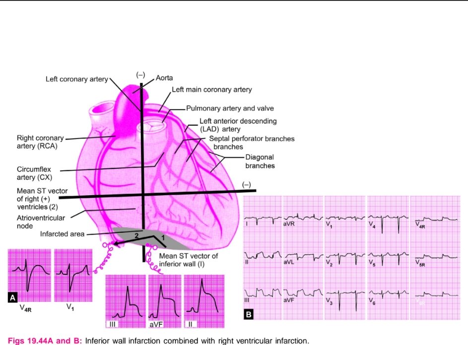 CardiovascularCorner tweet media