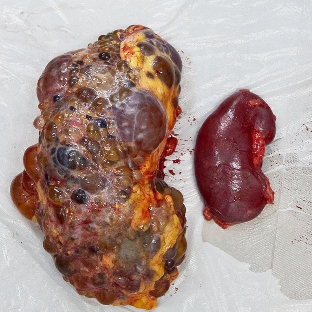 What is the diagnosis?