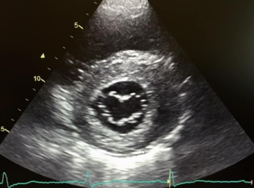 "Roses are red,
Not green like a gecko.
Let's spend the day
Looking at an echo." 🫀

#HappyValentinesDay #ASEHeart
