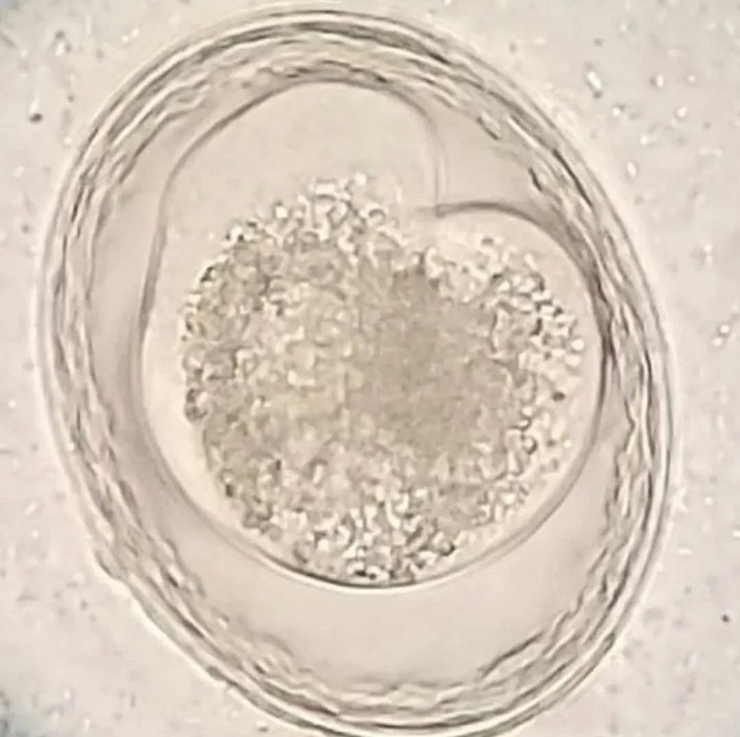 Happy Valentines Day from this heart shaped Toxascaris leonina ovum #parasitology