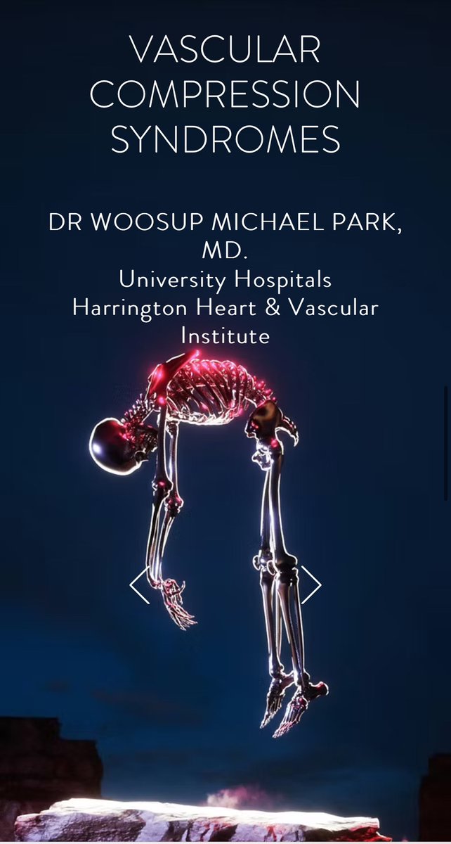 The Oxford Vascular Collaterals (@theovcs) on Twitter photo Thank U to <a href="/docpark/">W. Michael Park, MD</a> for exceptional insights: Vascular Compression Syndromes - OVC feature session now available via the homepage.
Credit to <a href="/JasonLawsonMD1/">JasonLawsonMD</a> awesome OVC media production & editing.
TheOxfordVascularCollaterals.com
<a href="/RouleauxClub/">Rouleaux Club</a> <a href="/HFrcs/">Higher FRCS - Higher Vasc - Higher VIVA</a> #vascsurg Thank U to <a href="/docpark/">W. Michael Park, MD</a> for exceptional insights: Vascular Compression Syndromes - OVC feature session now available via the homepage.
Credit to <a href="/JasonLawsonMD1/">JasonLawsonMD</a> awesome OVC media production & editing.
TheOxfordVascularCollaterals.com
<a href="/RouleauxClub/">Rouleaux Club</a> <a href="/HFrcs/">Higher FRCS - Higher Vasc - Higher VIVA</a> #vascsurg