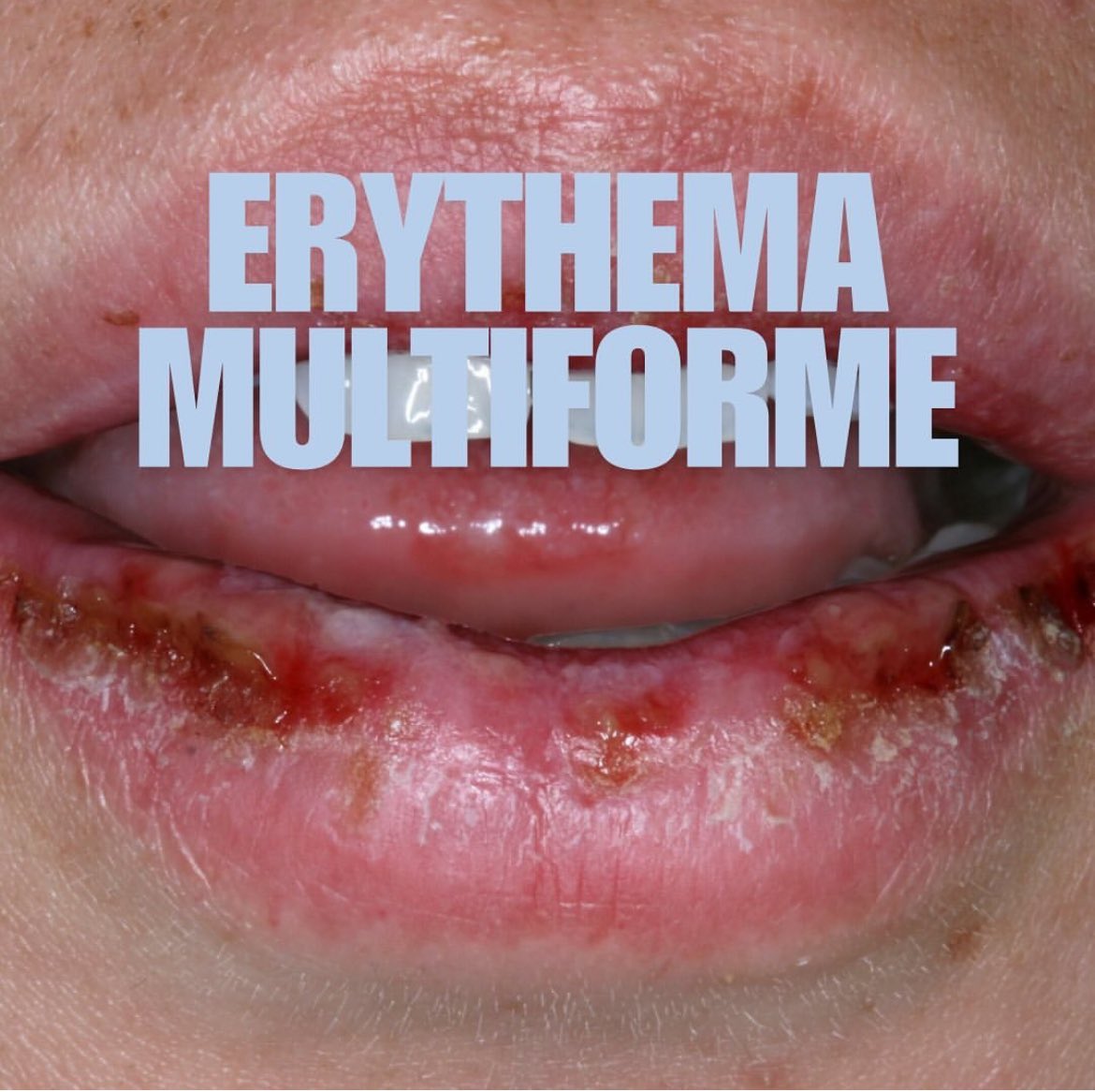 Ahmed Muharraq (@ahmadalmoharrg) on Twitter photo 