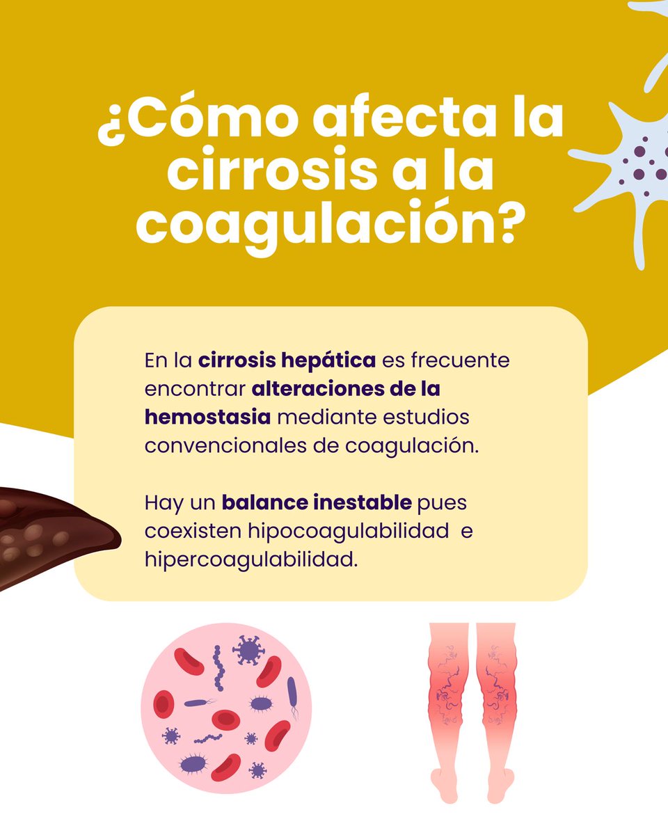 congresomedigen's tweet photo. ¿Sabías que en la cirrosis hepática pueden coexistir sangrado y trombosis al mismo tiempo? 🩸🩺

Acompáñanos en MEDIGEN para conocer más sobre ello 📚🔬🪻✨

#unidosporelconocimiento #medigen #facmedunam #coagulacion #medicina https://t.co/6nrtmYAotG