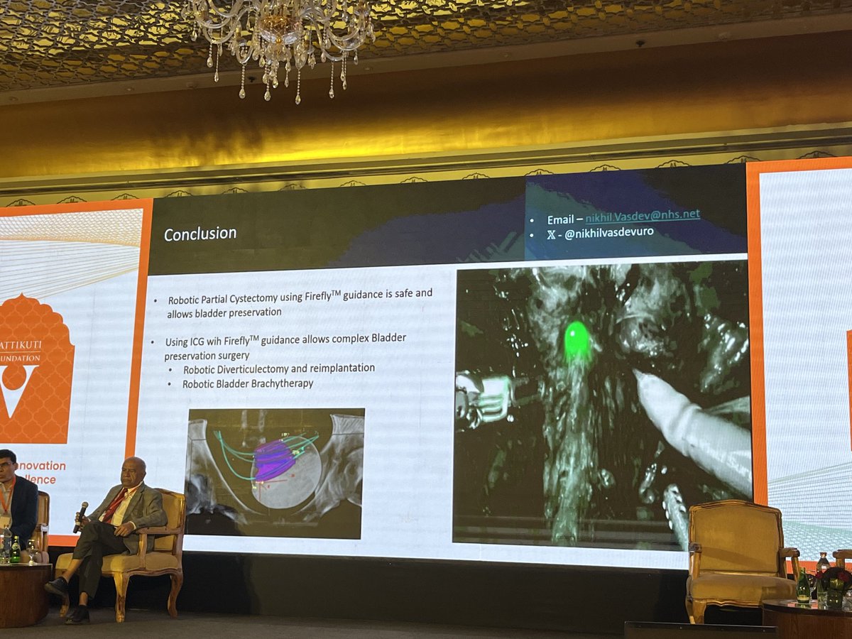 Prof. Prokar Dasgupta OBE (@prokarurol) on Twitter photo <a href="/nikhilvasdevuro/">Prof Nikhil Vasdev</a> on Fluorescence guided robotic partial cystectomy for adenocarcinoma bladder <a href="/VattikutiRobotx/">Vattikuti Foundation</a> in #Jaipur
Clever use of a flexible cystoscope to exactly locate the tumour
🤖Clear margins in 23 patients
🤖1 metastasis to bone <a href="/nikhilvasdevuro/">Prof Nikhil Vasdev</a> on Fluorescence guided robotic partial cystectomy for adenocarcinoma bladder <a href="/VattikutiRobotx/">Vattikuti Foundation</a> in #Jaipur
Clever use of a flexible cystoscope to exactly locate the tumour
🤖Clear margins in 23 patients
🤖1 metastasis to bone