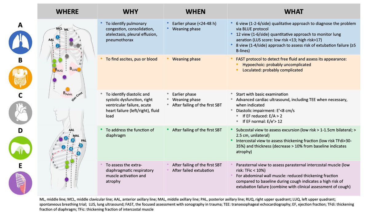 #MedicinaInterna #MedicinaCrítica
El enfoque ABCDE de ultrasonido para el retiro de la ventilación mecánica.

Intensive Care Med. 2025. doi:10.1007/s00134-024-07753-5
