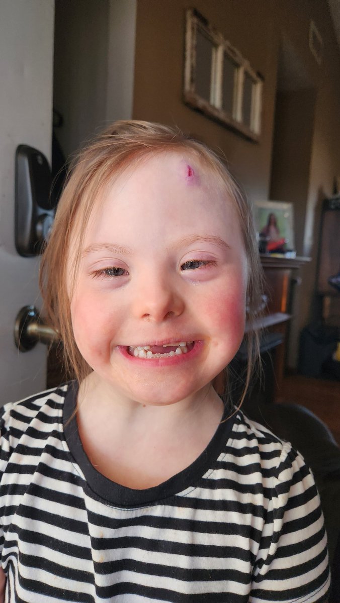 Spent the afternoon yesterday in the ER with <a href="/ClaraMcGruff/">Clara McGruff</a> getting her forehead glued shut.

Was running at recess, tripped, and landed head first into a fence post leaving a nasty gash.

She handled it like a warrior. No tears and was wonderful with the nurses and Doc.

You'd