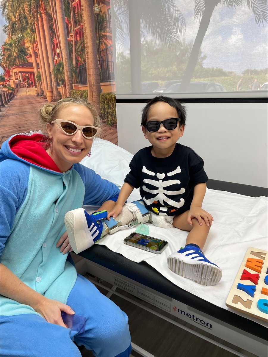 Meet Odin! This determined young boy was born with tibial hemimelia. After undergoing limb reconstruction, he’s made incredible progress, thanks to his hard work and the unwavering support of his family. I look forward to seeing him back for lengthening in the future!