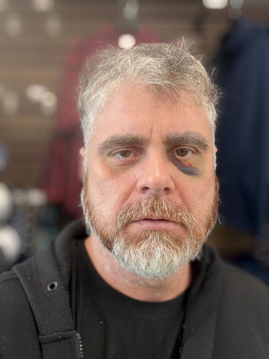 Alien.base.eth (@memecoinalien) on Twitter photo This man once was the biggest Crypto YouTuber
Then he lost it all
Hereβs the wild story of BitBoy Crypto
<a href="/BenArmstrongsX/">The BitBoy</a>
π§΅ This man once was the biggest Crypto YouTuber
Then he lost it all
Hereβs the wild story of BitBoy Crypto
<a href="/BenArmstrongsX/">The BitBoy</a>
π§΅