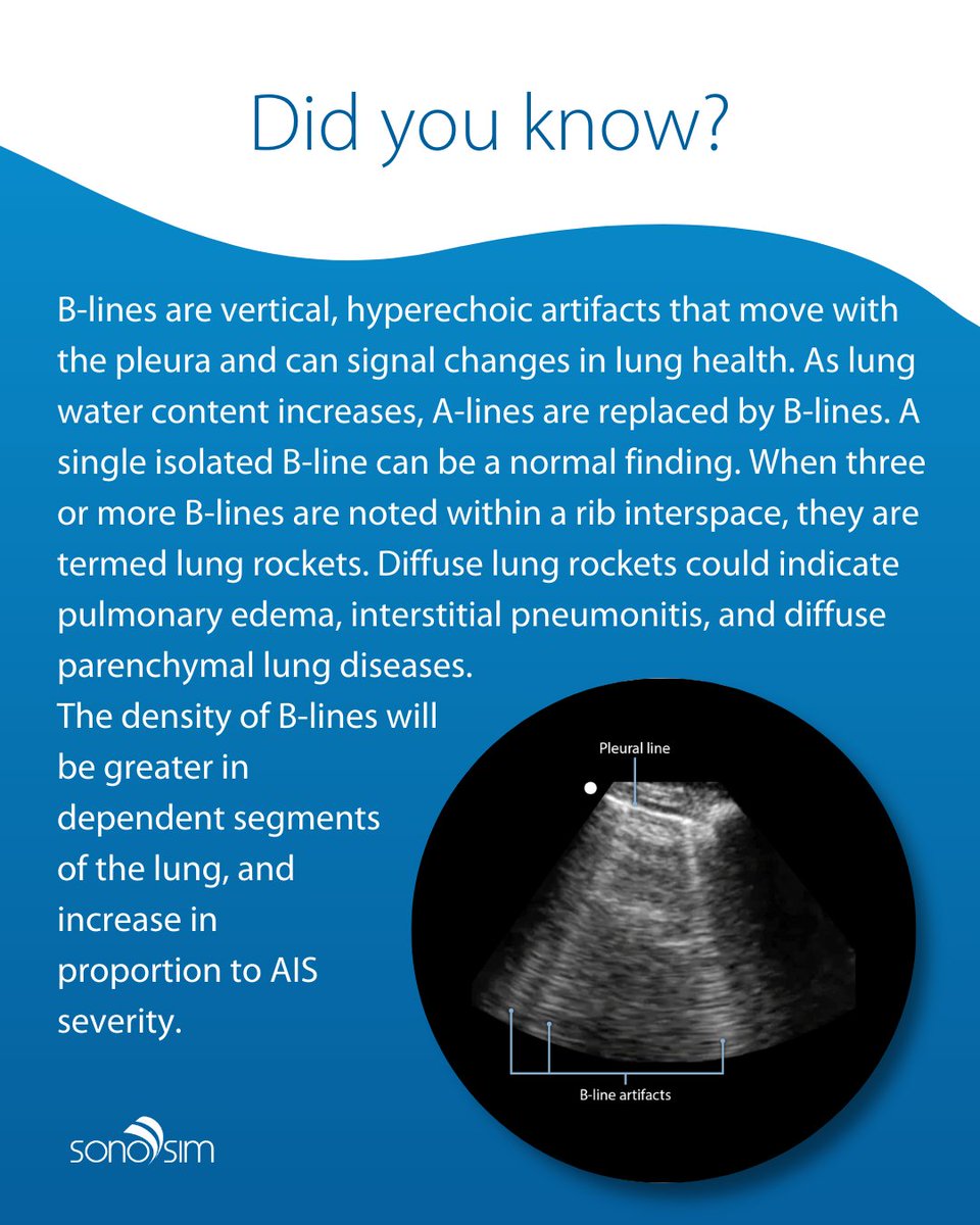 Ultrasound is a powerful tool for assessing lung pathology—are you using it to its full potential? 🔍🫁 #ultrasound #lungultrasound #sonosim #medsim