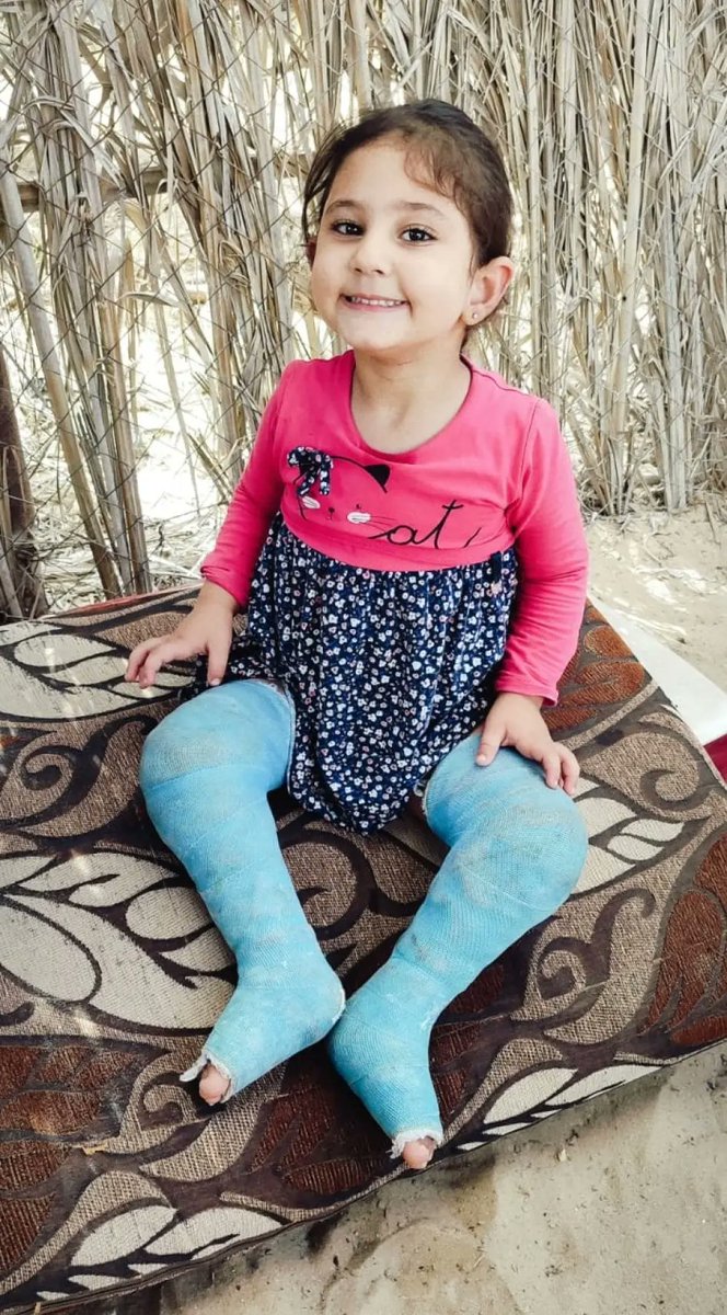 Israel is blocking doctors from entering Gaza to provide care urgently needed given its assault on Gaza's health care system—causing surgery to address 3-year-old Minah's clubfoot condition to be called off. States should press Israel to let docs in. <a href="/hrw/">Human Rights Watch</a> 
hrw.org/news/2025/02/2…