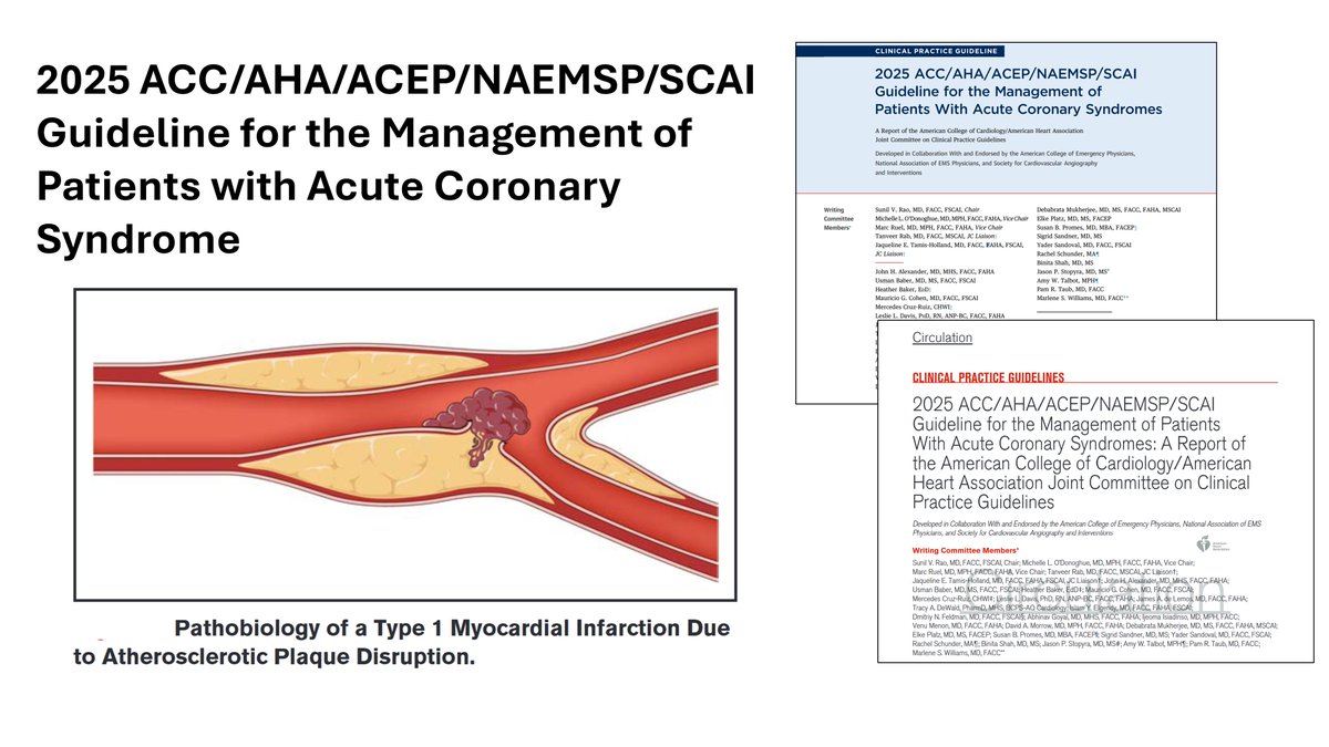 Yader Sandoval (@yadersandoval) on Twitter photo Now online: 2025 ACC/AHA/ACEP/NAEMSP/SCAI Guideline for the Management of Patients With Acute Coronary Syndromes <a href="/JACCJournals/">JACC Journals</a>➡️bit.ly/4gWAo1y <a href="/CircAHA/">Circulation</a> ➡️bit.ly/3Dkn35d <a href="/ACCinTouch/">American College of Cardiology</a> <a href="/AHAScience/">AHA Science</a> <a href="/SCAI/">SCAI</a> <a href="/SVRaoMD/">Sunil V. Rao</a> <a href="/DrM_ODonoghue/">Michelle O'Donoghue</a> <a href="/HollandTamis/">Jacqueline Tamis-Holland</a> Now online: 2025 ACC/AHA/ACEP/NAEMSP/SCAI Guideline for the Management of Patients With Acute Coronary Syndromes <a href="/JACCJournals/">JACC Journals</a>➡️bit.ly/4gWAo1y <a href="/CircAHA/">Circulation</a> ➡️bit.ly/3Dkn35d <a href="/ACCinTouch/">American College of Cardiology</a> <a href="/AHAScience/">AHA Science</a> <a href="/SCAI/">SCAI</a> <a href="/SVRaoMD/">Sunil V. Rao</a> <a href="/DrM_ODonoghue/">Michelle O'Donoghue</a> <a href="/HollandTamis/">Jacqueline Tamis-Holland</a>