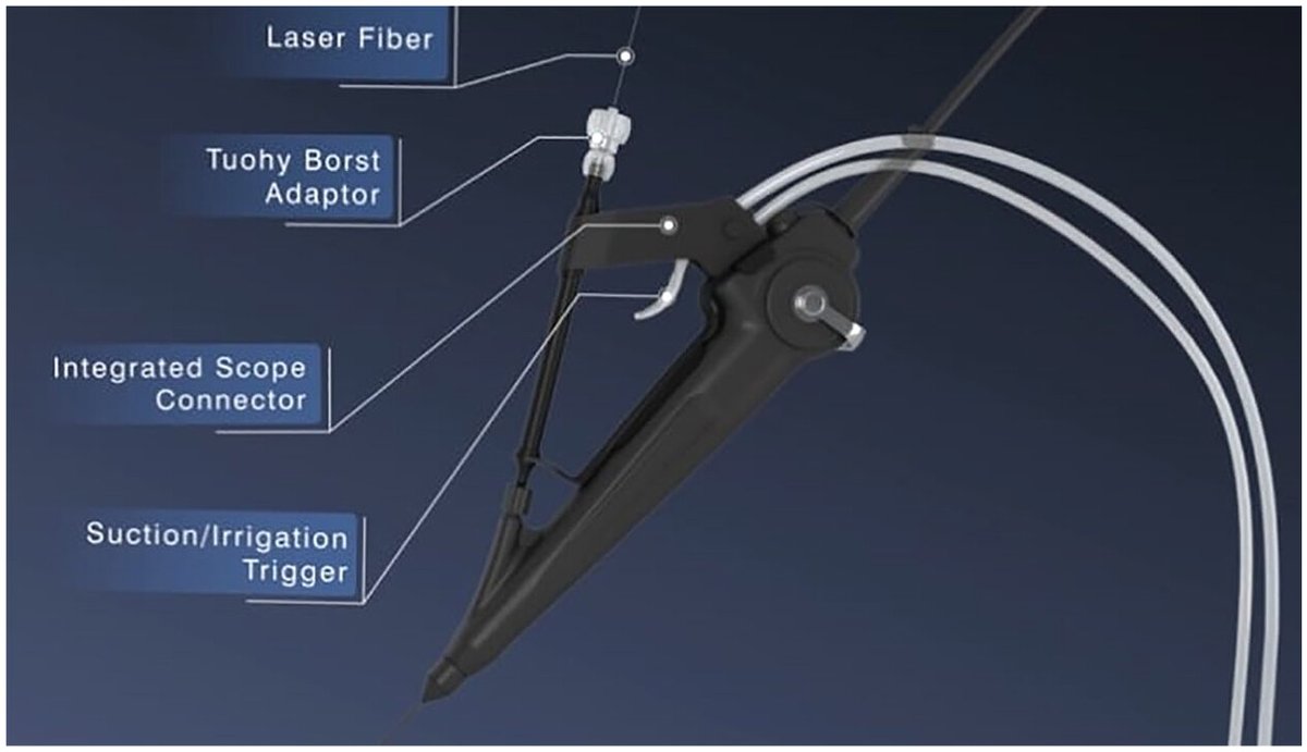Therapeutic Advances in Urology (@ta_urology) on Twitter photo 🌟Evaluation of the GLITZ system: a novel direct in-scope suction #DISS accessory mounted directly onto a flexible ureteroscope
🔖 bit.ly/3DkTjVR
<a href="/DocGauhar/">DrG</a> <a href="/OTRAXER/">Olivier Traxer</a> <a href="/endouro/">Prof Bhaskar Somani</a> <a href="/D_Castellani/">Daniele Castellani</a>
<a href="/drragoori/">𝘿𝙚𝙚𝙥𝙖𝙠 𝙍𝙖𝙜𝙤𝙤𝙧𝙞</a> <a href="/eulis_uroweb/">European Section of Urolithiasis - EULIS</a> 🌟Evaluation of the GLITZ system: a novel direct in-scope suction #DISS accessory mounted directly onto a flexible ureteroscope
🔖 bit.ly/3DkTjVR
<a href="/DocGauhar/">DrG</a> <a href="/OTRAXER/">Olivier Traxer</a> <a href="/endouro/">Prof Bhaskar Somani</a> <a href="/D_Castellani/">Daniele Castellani</a>
<a href="/drragoori/">𝘿𝙚𝙚𝙥𝙖𝙠 𝙍𝙖𝙜𝙤𝙤𝙧𝙞</a> <a href="/eulis_uroweb/">European Section of Urolithiasis - EULIS</a>
