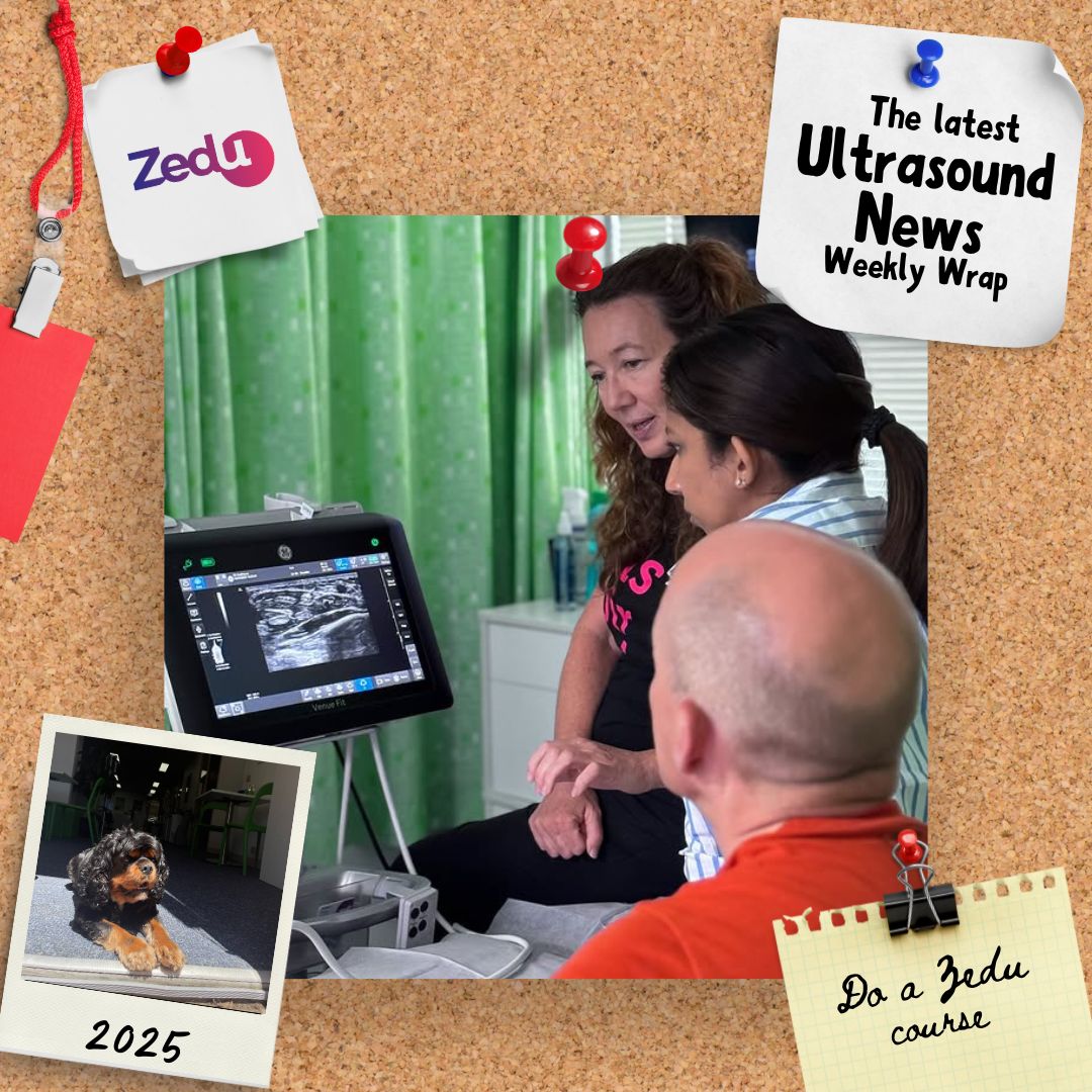 Zedu Ultrasound Training @zedunow@med-mastodon.com (@zedunow) on Twitter photo The last day of Summer is here🌞-so is the #WeeklyWrap
Get the latest & greates #ultrasound news from
<a href="/PratsEM/">Michael I. Prats</a>
<a href="/MH_EMultrasound/">MetroHealth Emergency Ultrasound</a>
<a href="/Issac80/">Issac Cheong</a>
<a href="/drfreeze/">D</a>.bsky.social
@mededpocus.bsky.social
👇👇And so much more🔥🔥
ultrasoundtraining.com.au/news/zedu-week…
#POCUS #ultrasoundtraining The last day of Summer is here🌞-so is the #WeeklyWrap
Get the latest & greates #ultrasound news from
<a href="/PratsEM/">Michael I. Prats</a>
<a href="/MH_EMultrasound/">MetroHealth Emergency Ultrasound</a>
<a href="/Issac80/">Issac Cheong</a>
<a href="/drfreeze/">D</a>.bsky.social
@mededpocus.bsky.social
👇👇And so much more🔥🔥
ultrasoundtraining.com.au/news/zedu-week…
#POCUS #ultrasoundtraining
