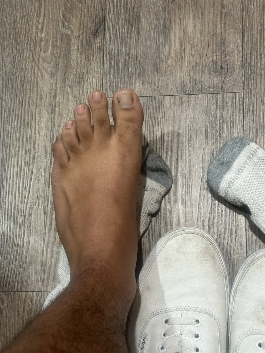 Mens feet tweet media