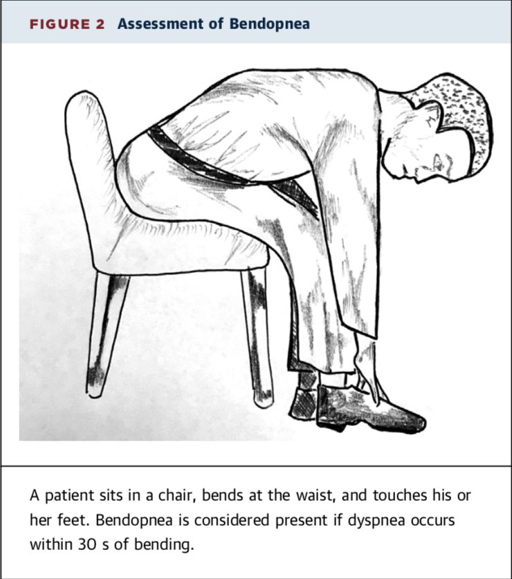 Bendopnea. 🫀😨💨
☑️La bendopnea es la aparición de un aumento de la disnea al inclinarse hacia adelante y se asocia con un aumento de la presión auricular derecha y de la presión de enclavamiento pulmonar (correlaciona con una enfermedad más avanzada en pacientes con HP). 🫀💢🫁