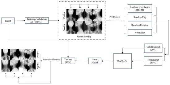 Sensors_MDPI's tweet photo. Cervical Spondylosis Diagnosis Based on Convolutional Neural Network with X-ray Images
https://t.co/Ggkt3l5U9C
#cervical #spondylosis; #X-ray #classification; #multi-label; #deep learning https://t.co/UzCmUbDI46