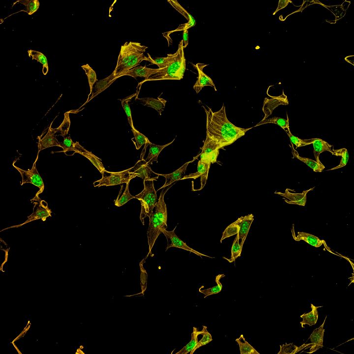 Optolongfilter's tweet image. Achievement: Fluorescence test image with Osmanthus fragrans stem.
Photographed by Daniel Han.
Images were captured by #Optolongfluorescencefilter single band #FITC(30025), #FISHorange(30033) .
Taken with Olympus microscope,Nikon camera.

#fluorescence #fitc #excitationfilter