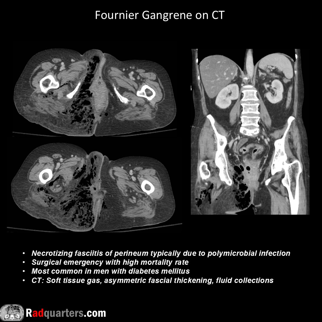 Radquarters's tweet image. #FOAMrad #FOAMed #radres #radtech #medstudent #radquarters