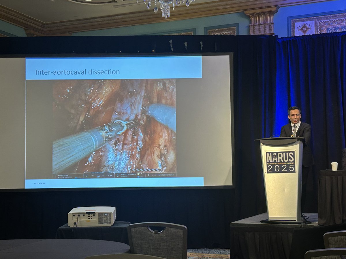 City of Hope Surgery (@cityofhopesurg) on Twitter photo Our esteemed <a href="/CityofHopeSurg/">City of Hope Surgery</a> #Urology faculty <a href="/ClaytonLauMD/">Clayton Lau</a> & <a href="/AliZUroOnc/">Ali Zhumkhawala, MD</a> participating as presenters and panelists <a href="/RoboUro/">North American Robotic Urology Society | NARUS</a> #NARUS2025 <a href="/COHurol/">Kevin Chan, MD</a> <a href="/WesleyYipMD/">Wesley Yip</a> <a href="/BYuhMD/">Bertram Yuh</a> <a href="/jyamzonmd/">Jonathan Yamzon</a> <a href="/CityofHope_GU/">Genitourinary Cancer Research Team @CityofHope</a> <a href="/cityofhope/">City of Hope</a> Our esteemed <a href="/CityofHopeSurg/">City of Hope Surgery</a> #Urology faculty <a href="/ClaytonLauMD/">Clayton Lau</a> & <a href="/AliZUroOnc/">Ali Zhumkhawala, MD</a> participating as presenters and panelists <a href="/RoboUro/">North American Robotic Urology Society | NARUS</a> #NARUS2025 <a href="/COHurol/">Kevin Chan, MD</a> <a href="/WesleyYipMD/">Wesley Yip</a> <a href="/BYuhMD/">Bertram Yuh</a> <a href="/jyamzonmd/">Jonathan Yamzon</a> <a href="/CityofHope_GU/">Genitourinary Cancer Research Team @CityofHope</a> <a href="/cityofhope/">City of Hope</a>