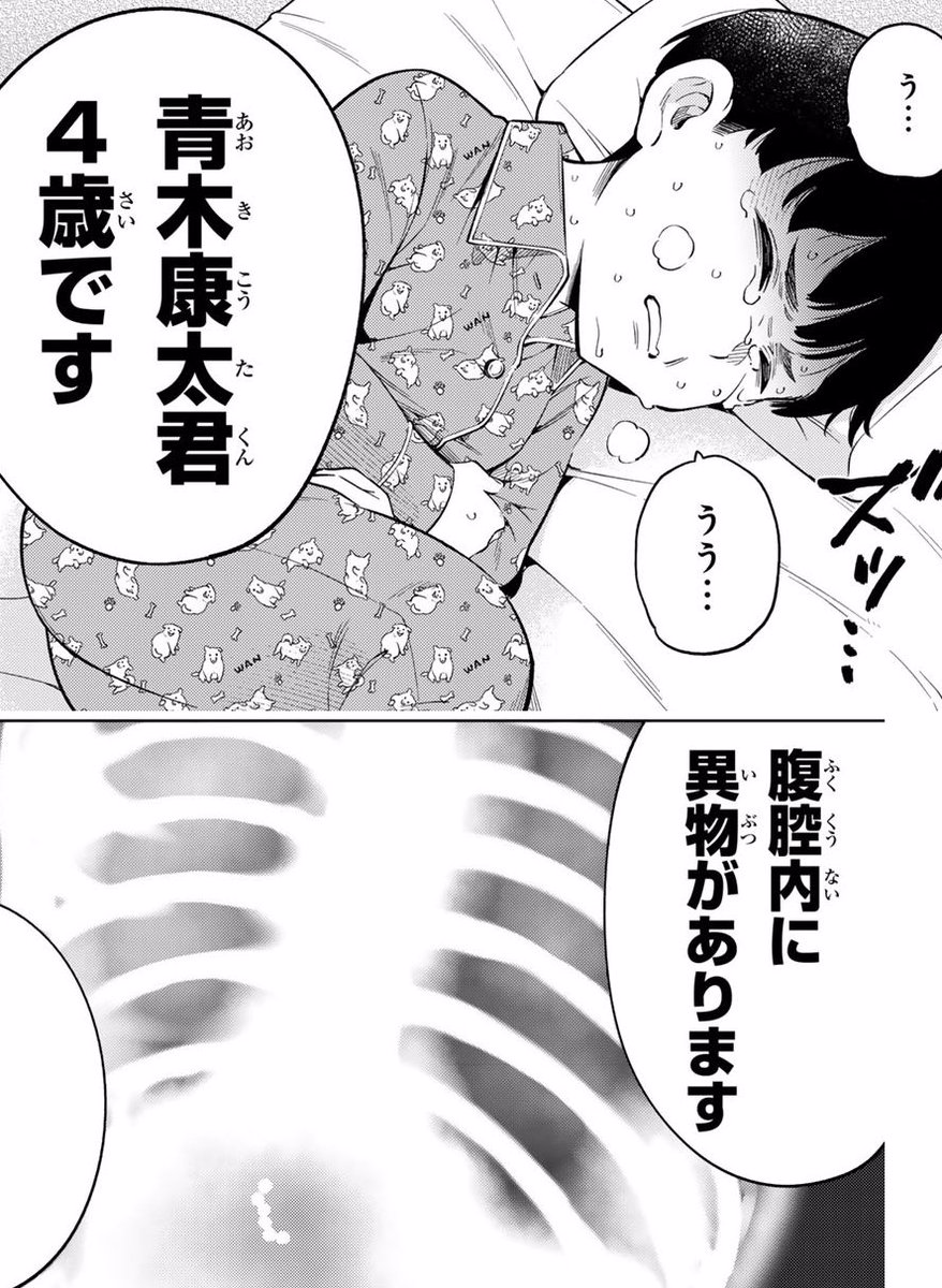 ユーチューバーの子どもが、撮影用の超強力磁石を誤飲してしまい、手術をする話。再掲
(0/12)