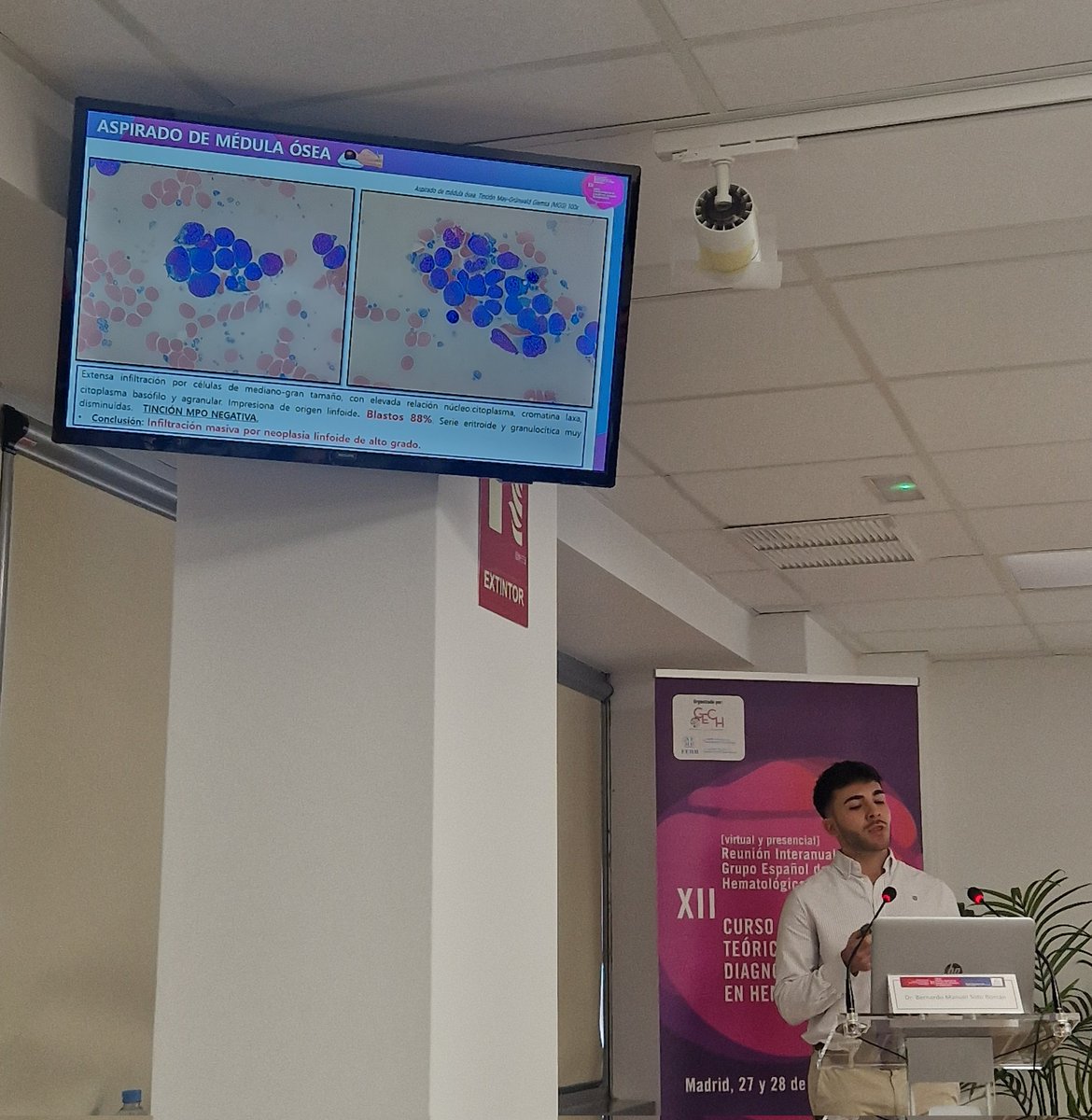 Seguimos hoy con la 2da jornada de la Reunión interanual del GECH  XII curso teórico práctico de diagnóstico integrado en Hematología <a href="/sehh_es/">@sehh_es</a>