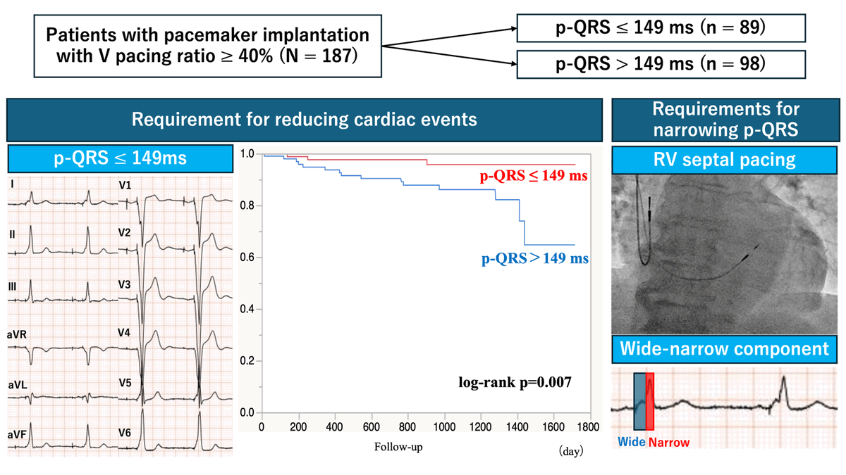 A p-QRS duration of less than 149 ms was associated with the reduction of cardiac events.Wide-narrow waveform by RV septal pacing was more frequent in patients with mid-range QRS duration.
By Yuichiro Miyazaki
doi.org/10.1253/circj.…
#circ_j #CardioX