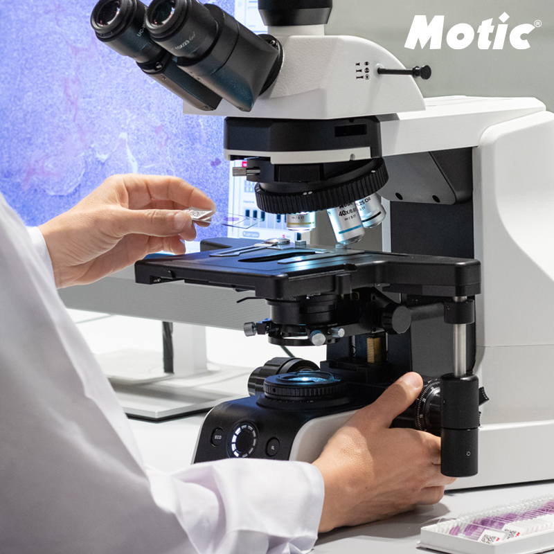 More than ever, on #WorldRareDiseaseDay, we continue to provide innovative solutions for research and diagnosis, which are crucial for improving the quality of life of those facing these challenges.
Together, we can make a difference.
#Awareness #Research #EarlyDiagnosis