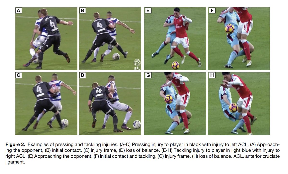 Matt Buckthorpe (@m_buckthorpe) on Twitter photo Our (<a href="/IsokineticMed/">Isokinetic</a>) latest video analysis study is out in <a href="/OJSM_SportsMed/">OJSM_SportsMed</a> on elite English male football. Open Access
➡️>indirect (42%) & direct (19%) contact (38% NC)
➡️2/3 defending
➡️>2/3 during tackling/pressing or tackled
➡️>1st half (57%)
shorturl.at/dEvHr Our (<a href="/IsokineticMed/">Isokinetic</a>) latest video analysis study is out in <a href="/OJSM_SportsMed/">OJSM_SportsMed</a> on elite English male football. Open Access
➡️>indirect (42%) & direct (19%) contact (38% NC)
➡️2/3 defending
➡️>2/3 during tackling/pressing or tackled
➡️>1st half (57%)
shorturl.at/dEvHr