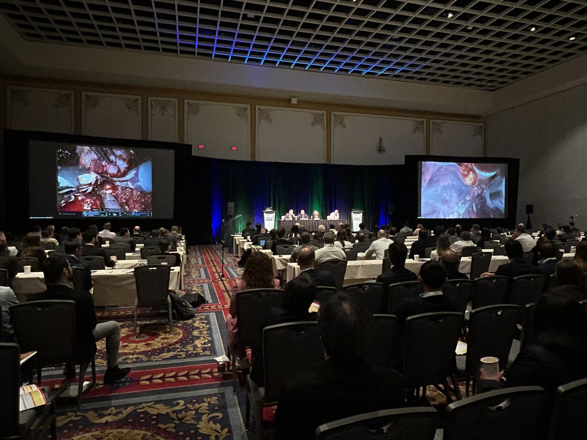 Assen Alexandrov, MD (@assenalexandrov) on Twitter photo If you looking for inspiration, this is the right place! #NARUS2025
LIVE SURGERY #1: Complex Radical Prostatectomy (Da Vinci 5) by <a href="/mdstifelman/">Michael Stifelman</a>
LIVE SURGERY #2: Partial Nephrectomy (Da Vinci SP) by <a href="/NYCRoboticTeam/">Ketan K. Badani MD</a> If you looking for inspiration, this is the right place! #NARUS2025
LIVE SURGERY #1: Complex Radical Prostatectomy (Da Vinci 5) by <a href="/mdstifelman/">Michael Stifelman</a>
LIVE SURGERY #2: Partial Nephrectomy (Da Vinci SP) by <a href="/NYCRoboticTeam/">Ketan K. Badani MD</a>