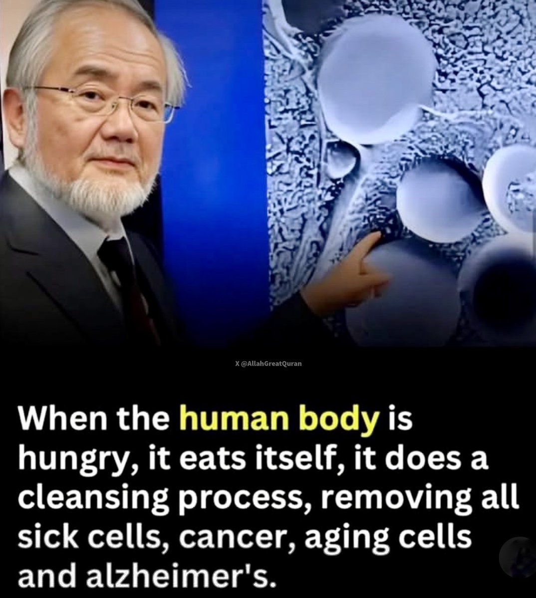 Alhumdulillah for Islam. Because Fasting is one of the Five Pillars of Islam