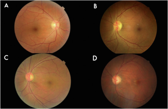Ophthalmology tweet media