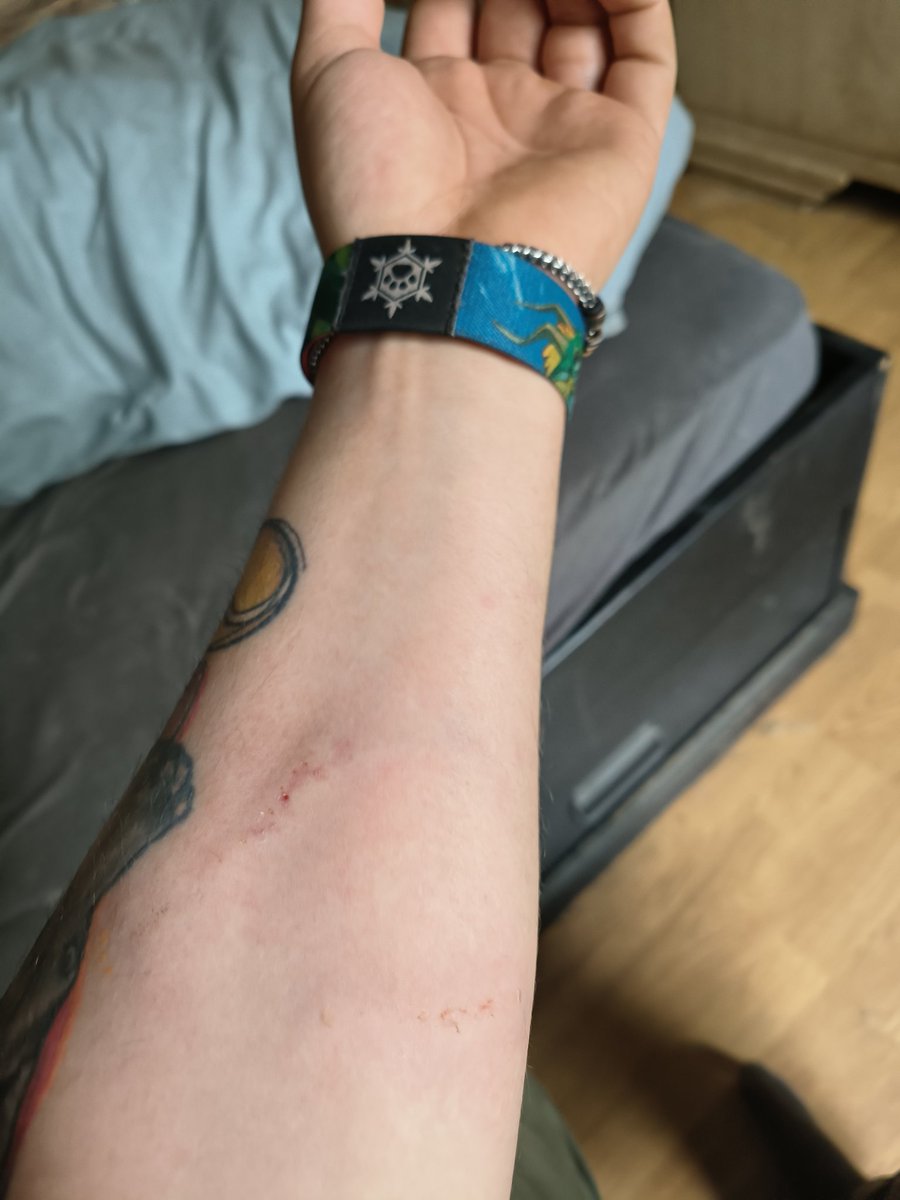 Little update about this morning of my dog attacking me. 
No need to go to the hospital luckily and no stitches needed. 
Only one wound went through the skin as I've cleaned it and treated with care 
Now all needs to heal .
