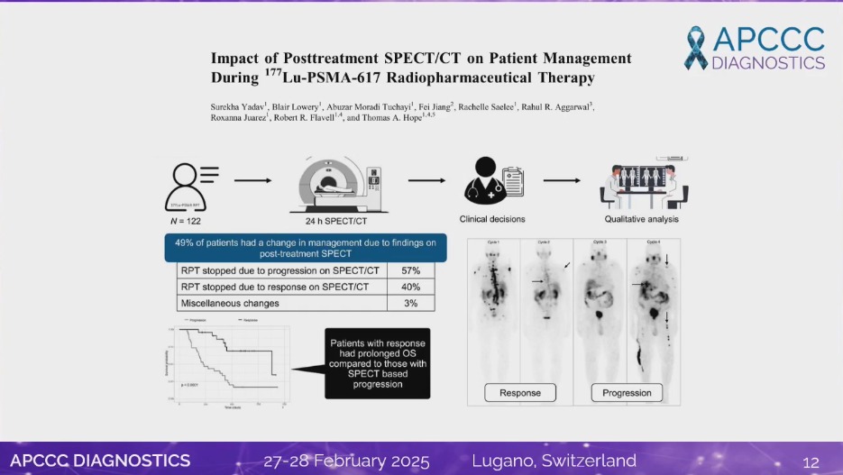 nataliagandur's tweet photo. ππ΅ LIVE from #APCCC25! #APCCCDiagnostics25
π’ Monitoring of patients on PSMA-radioligand therapy
π₯ Masterful presentation by Andrei Iagaru on optimizing monitoring strategies for patients receiving PSMA-radioligand therapy!
@APCCC_Lugano @OncoAlert
π Key highlights:
β
Cost comparison of imaging modalities: FDG-PET, PSMA-PET, and 177Lu-PSMA-617 SPECT/CT
β
Patient selection criteria using PSMA & FDG PET/CT for therapy eligibility
β
Post-treatment SPECT/CT: 49% of patients had management changes due to imaging findings
β
Impact on survival: Patients with SPECT-based response had prolonged OS compared to those with progression
π Optimizing imaging strategies is critical for patient selection and response evaluation! π
@ProfKHerrmann @stefanofanti4 @Silke_Gillessen @AOmlin @Albert0Briganti @Ecastromarcos @drlouiseemmett @DrAGafita @karolien_goffin @ProfHadaschik @DrMHofman @Prof_Nick_James @piet_ost @gpalapa2 @MoniqueRoobol @TylerSbrt @DrSpratticus @Tilki_De @BertrandTOMBAL @Nina18205 @UrsulaVogl @ResearchWyatt π