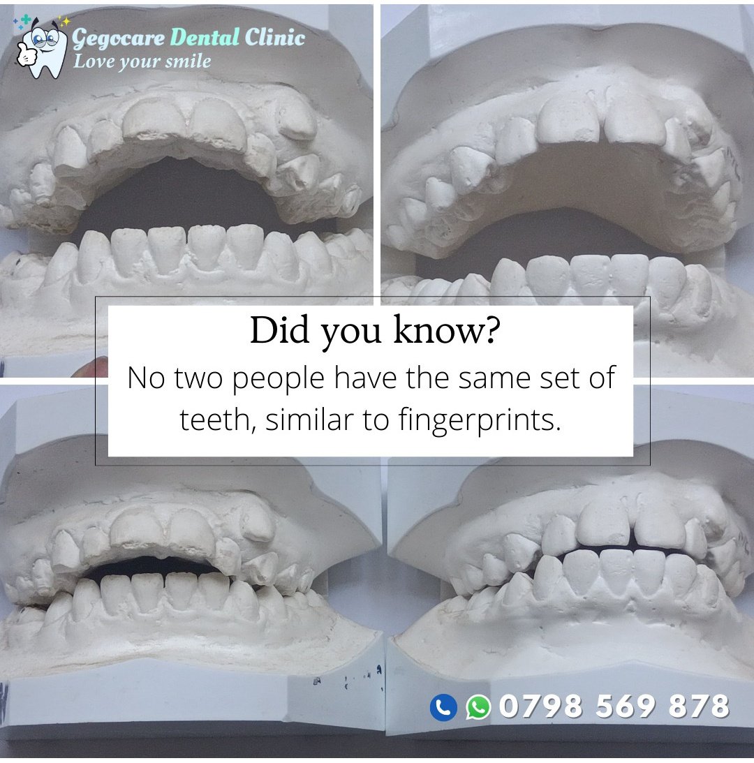 gegocare's tweet photo. Did you know? No two people in the world have the exact same set of teeth! Just like fingerprints, your teeth have unique shapes, sizes, and alignment patterns—making your smile one of a kind. So, next time you flash that smile, remember—it's 100% YOU. #loveyoursmile #dentalfact https://t.co/B5no0ykGqU
